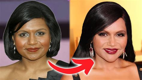 mindy kaling plastic surgery|Mindy Kaling’s Transformative Journey: Plastic Surgery ...